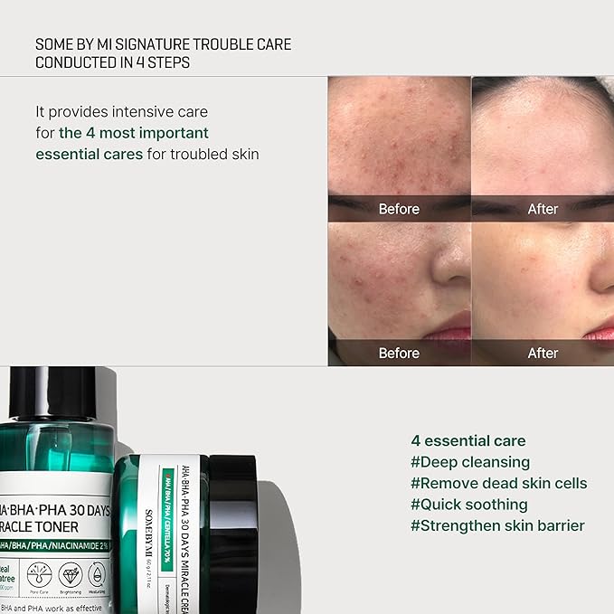SOME BY MI AHA BHA PHA 30 Days Miracle AC SOS Kit