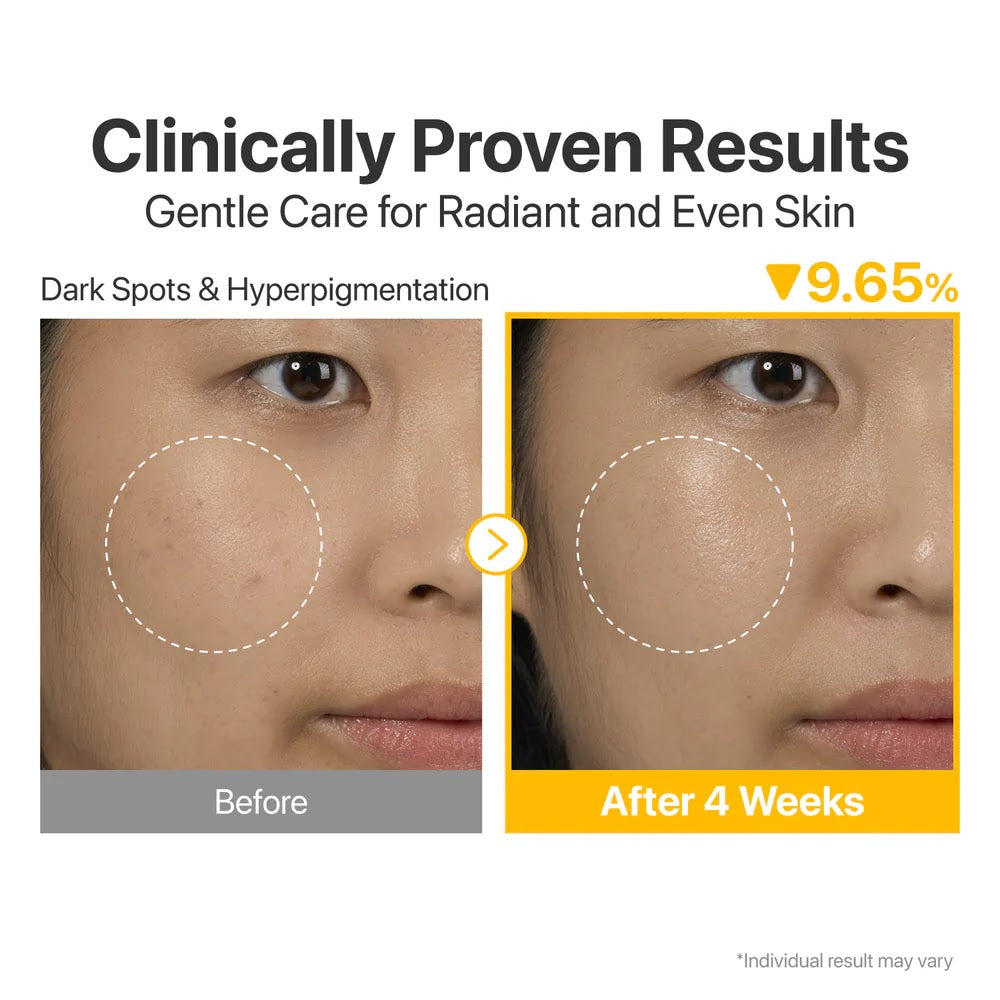 numbuzin No.5 Vitamin-Concentrated Serum