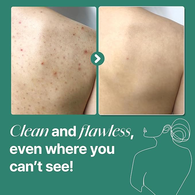 SOME BY MI AHA BHA PHA 30 Days Miracle Acne Clear Body Cleanser 400g