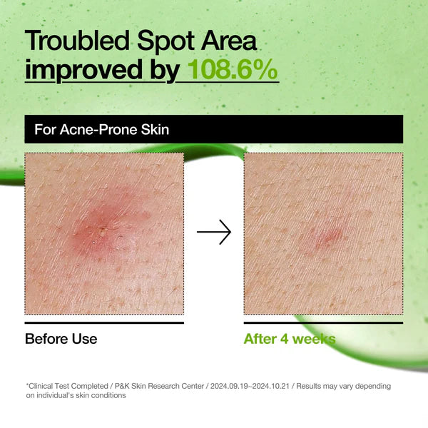 ANUA Azelaic Acid 10 Hyaluron Redness Soothing Serum 30m